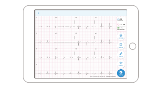 QT ECG mobile app