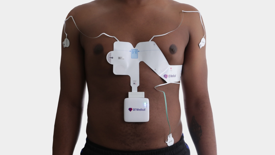 There Is a Better Way to Get a Standard 12-Lead ECG Test During the COVID-19 Pandemic