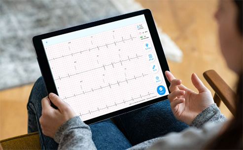 宇心生醫打破ECG心電圖檢查高牆 透過居家12導程ECG系統守護你我的心